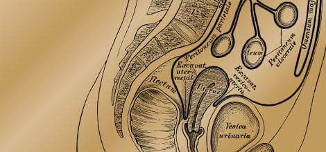 Delayed diagnosis of rectal cancer image